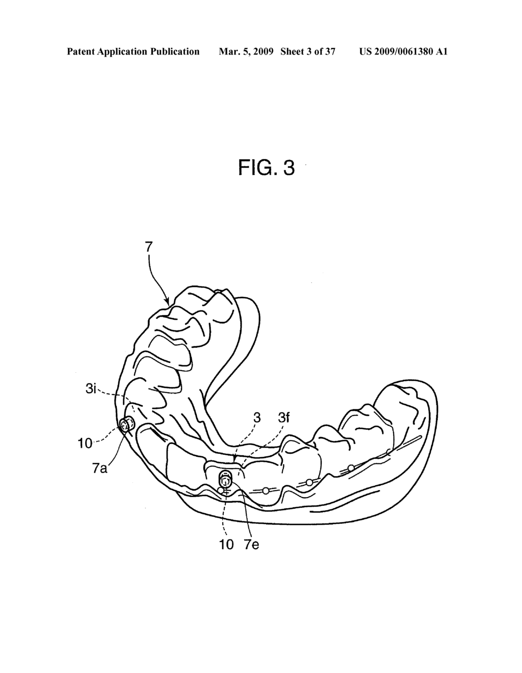 ORTHODONTIC APPLIANCE - diagram, schematic, and image 04