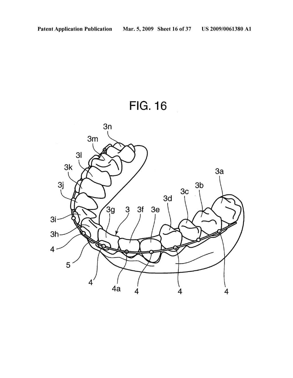 ORTHODONTIC APPLIANCE - diagram, schematic, and image 17