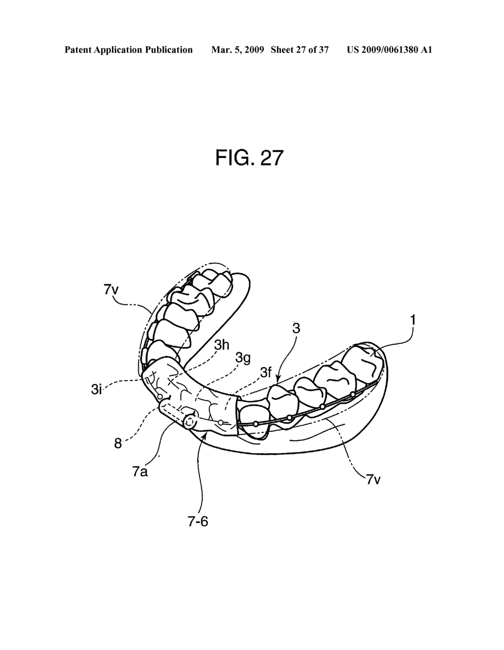 ORTHODONTIC APPLIANCE - diagram, schematic, and image 28