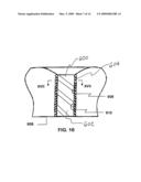 DENTAL IMPLANT PROSTHETIC DEVICE WITH IMPROVED OSSEOINTEGRATION AND SHAPE FOR RESISTING ROTATION diagram and image