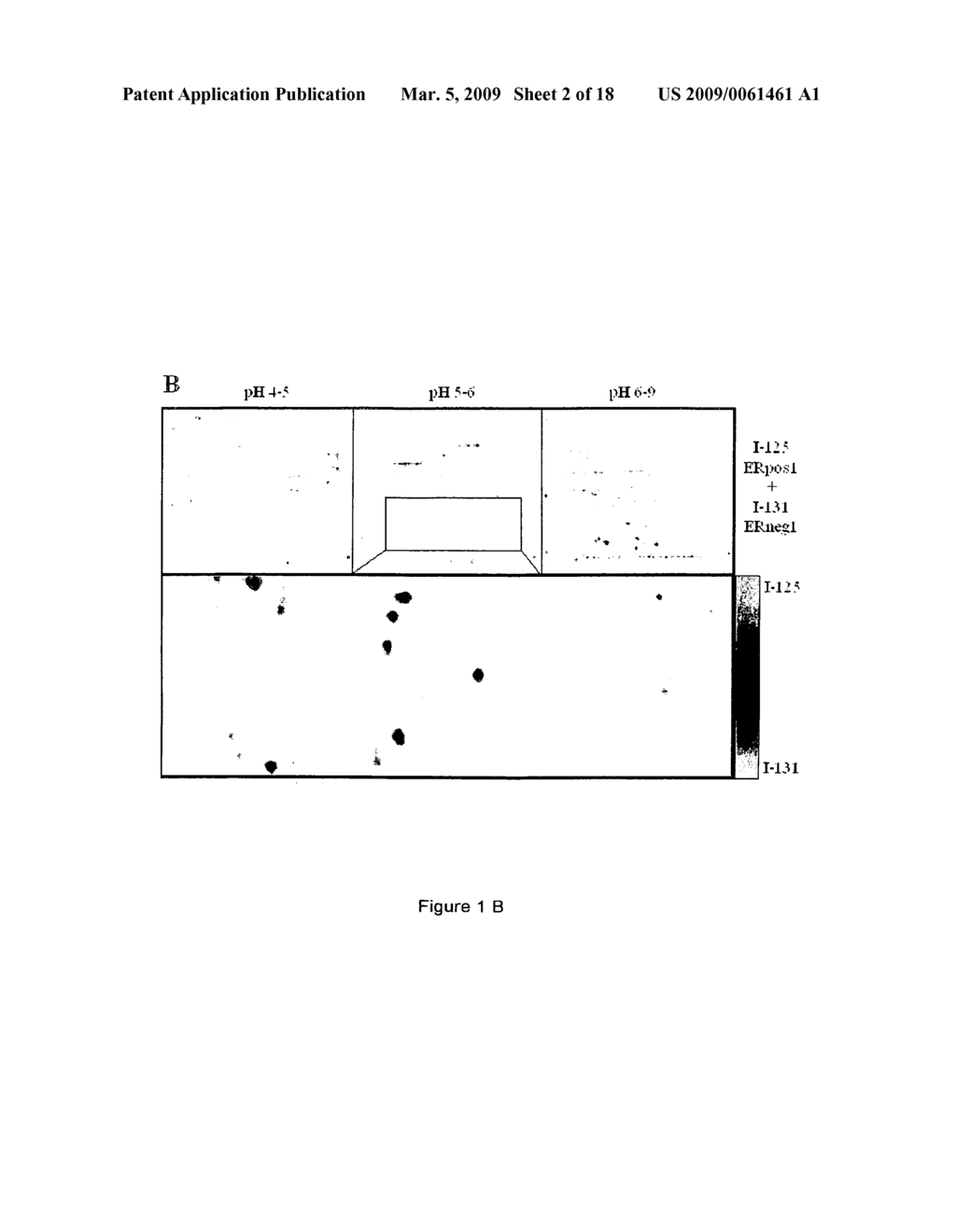 Phosphorylated or Non-Phosphorylated MPR as Diagnostic Marker or Therapeutic Target - diagram, schematic, and image 03