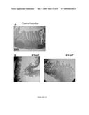 COMPOSITIONS AND METHODS FOR TREATING AND PREVENTING GASTROENTERIC DISEASES diagram and image