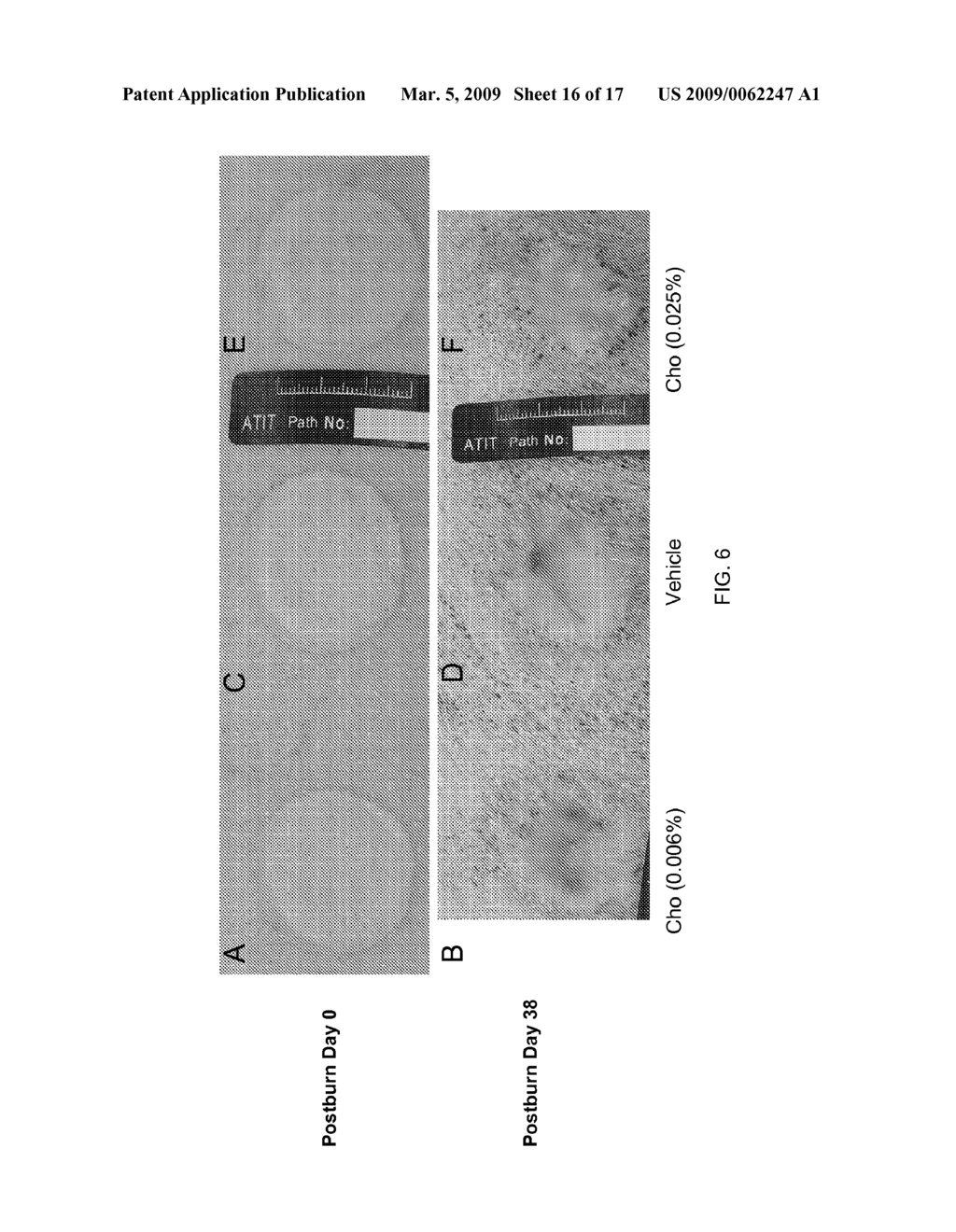 METHODS FOR INHIBITING TGF-beta - diagram, schematic, and image 17