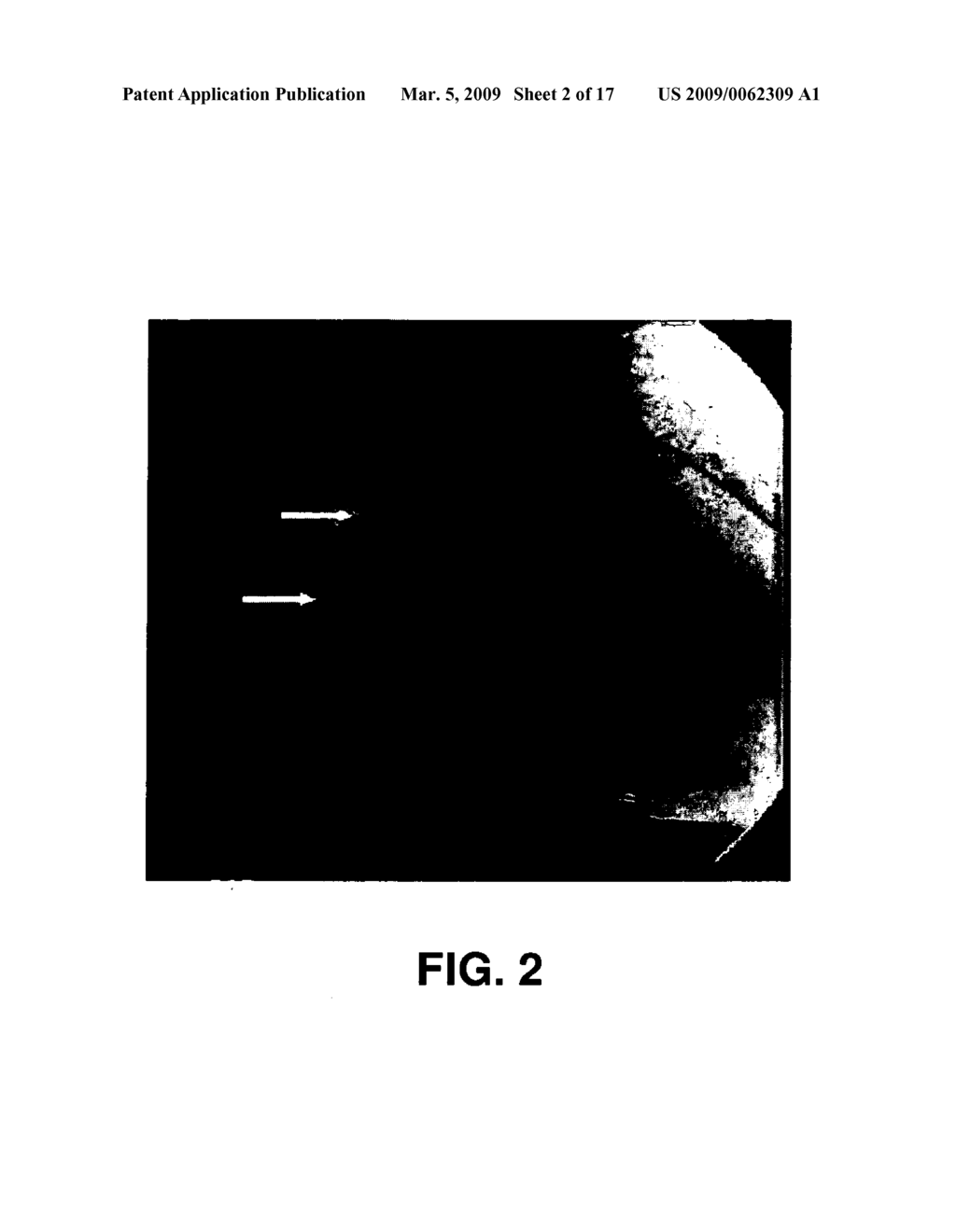 Therapeutic compositions for the treatment of cardiovascular diseases and methods for use therefor - diagram, schematic, and image 03