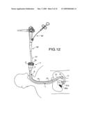 ENDOSCOPE GUIDING TUBE DEVICE diagram and image