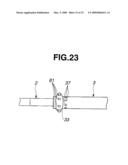 ENDOSCOPE APPARATUS diagram and image