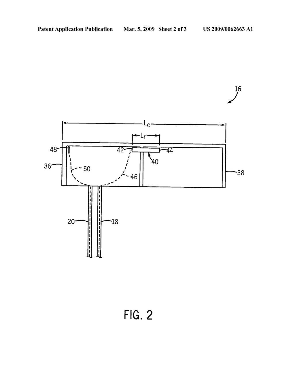 NON-INVASIVE BLOOD PRESSURE MONITOR APPARATUS AND SYSTEM - diagram, schematic, and image 03