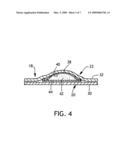 Thermal device for application to the spine diagram and image