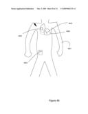 CONTROLLING BODY FLUID CONDITION USING DIURETICS diagram and image