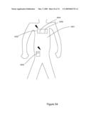 CONTROLLING BODY FLUID CONDITION USING DIURETICS diagram and image