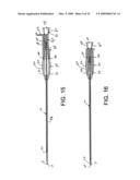 Gastropexy Kit diagram and image