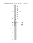 GUIDED CATHETER WITH REMOVABLE MAGNETIC GUIDE diagram and image