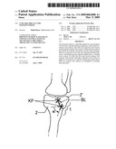 Clip-Like Implant for Osteosynthesis diagram and image