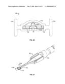 DEVICES AND METHODS FOR STORING, LOADING, AND DELIVERING AN INTRAOCULAR LENS diagram and image