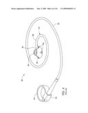 ADJUSTABLE IMPLANT AND METHOD OF USE diagram and image