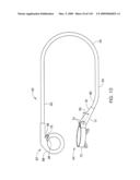 ADJUSTABLE IMPLANT AND METHOD OF USE diagram and image