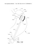 ADJUSTABLE IMPLANT AND METHOD OF USE diagram and image