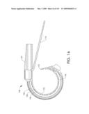 ADJUSTABLE IMPLANT AND METHOD OF USE diagram and image