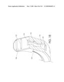 ADJUSTABLE IMPLANT AND METHOD OF USE diagram and image