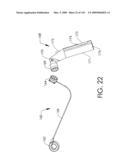 ADJUSTABLE IMPLANT AND METHOD OF USE diagram and image