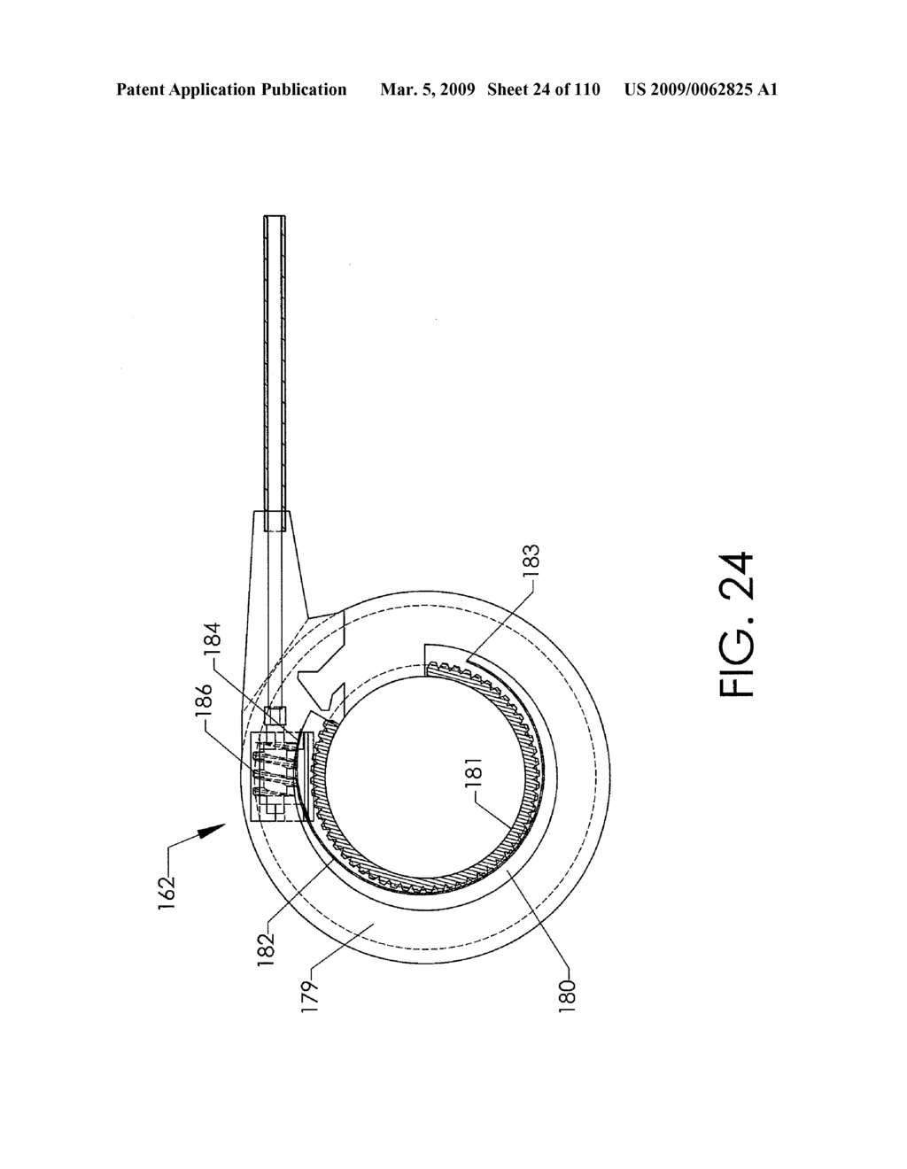 ADJUSTABLE IMPLANT AND METHOD OF USE - diagram, schematic, and image 25