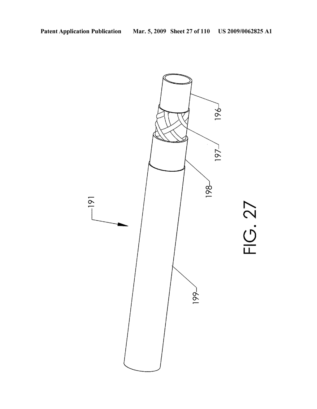 ADJUSTABLE IMPLANT AND METHOD OF USE - diagram, schematic, and image 28