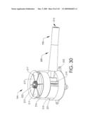 ADJUSTABLE IMPLANT AND METHOD OF USE diagram and image