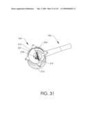 ADJUSTABLE IMPLANT AND METHOD OF USE diagram and image