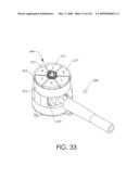 ADJUSTABLE IMPLANT AND METHOD OF USE diagram and image