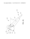 ADJUSTABLE IMPLANT AND METHOD OF USE diagram and image