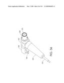 ADJUSTABLE IMPLANT AND METHOD OF USE diagram and image