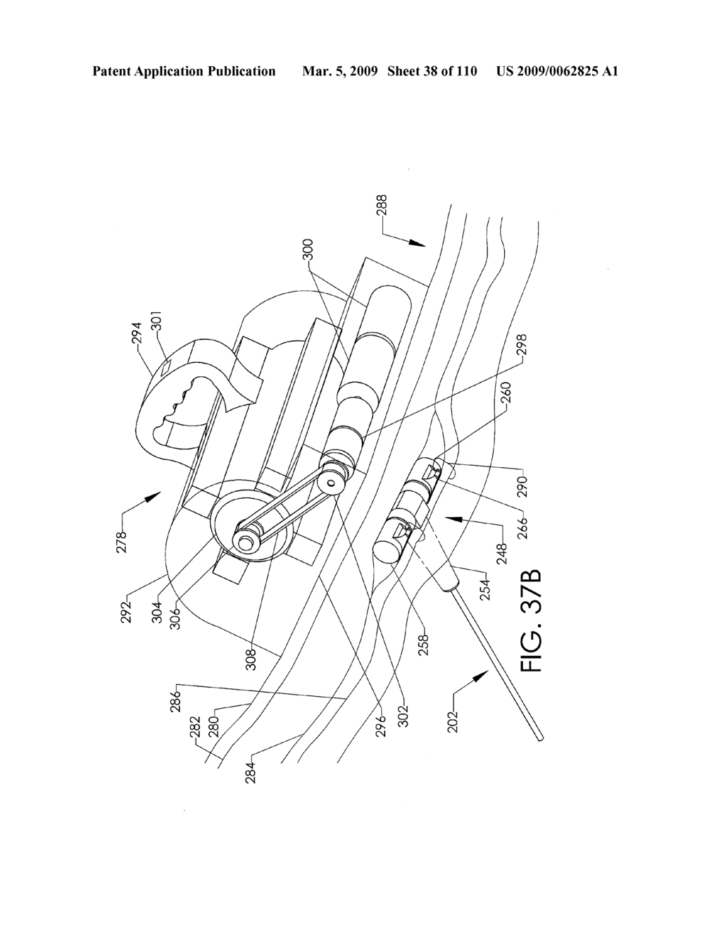 ADJUSTABLE IMPLANT AND METHOD OF USE - diagram, schematic, and image 39