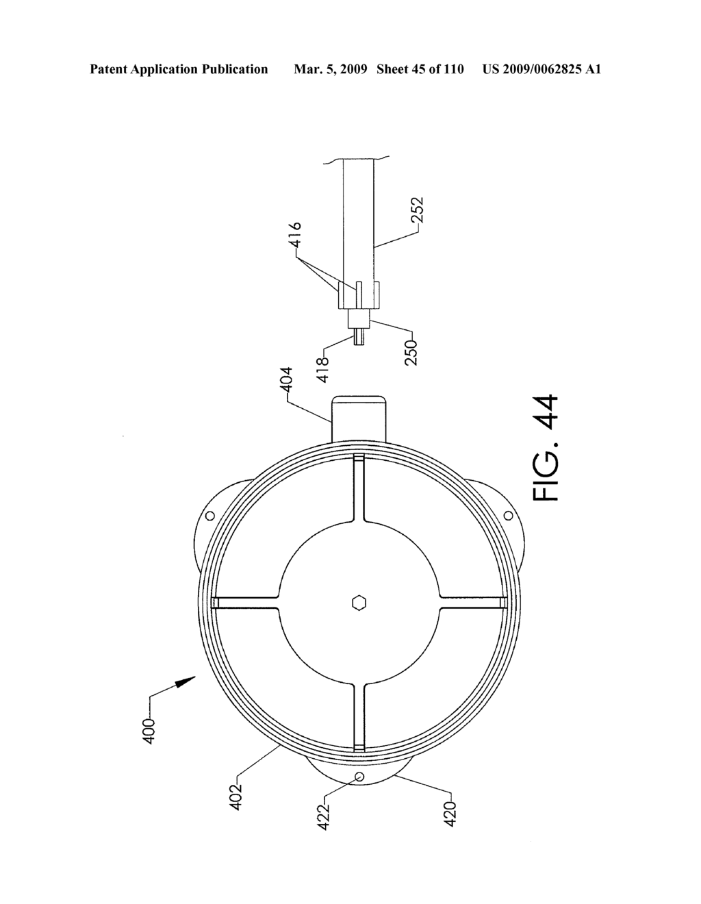 ADJUSTABLE IMPLANT AND METHOD OF USE - diagram, schematic, and image 46