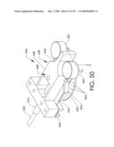 ADJUSTABLE IMPLANT AND METHOD OF USE diagram and image