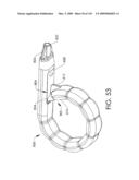 ADJUSTABLE IMPLANT AND METHOD OF USE diagram and image