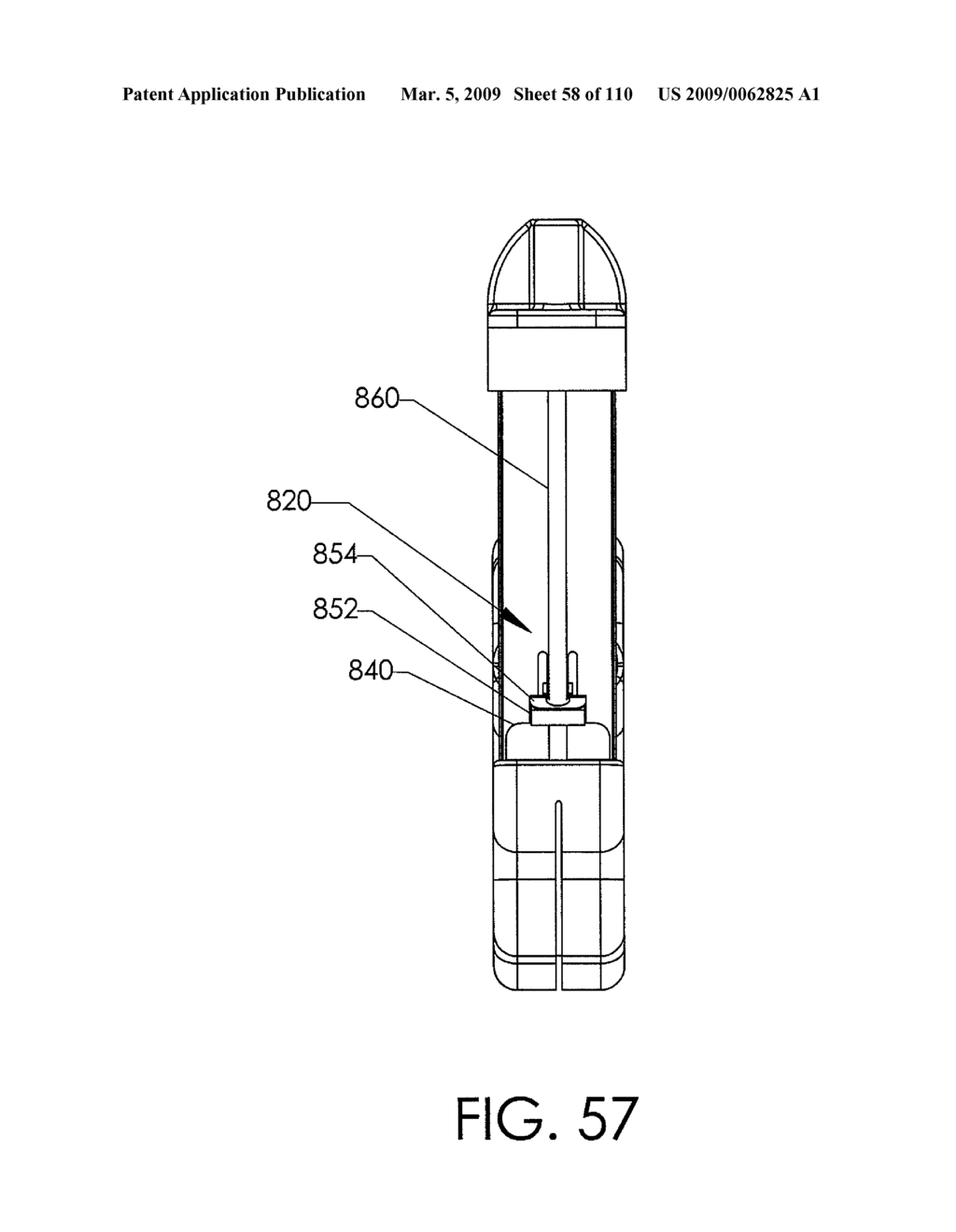 ADJUSTABLE IMPLANT AND METHOD OF USE - diagram, schematic, and image 59