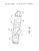 ADJUSTABLE IMPLANT AND METHOD OF USE diagram and image