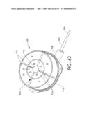 ADJUSTABLE IMPLANT AND METHOD OF USE diagram and image