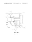 ADJUSTABLE IMPLANT AND METHOD OF USE diagram and image