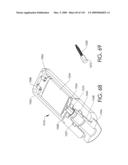 ADJUSTABLE IMPLANT AND METHOD OF USE diagram and image