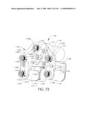 ADJUSTABLE IMPLANT AND METHOD OF USE diagram and image