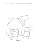 ADJUSTABLE IMPLANT AND METHOD OF USE diagram and image