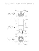 ADJUSTABLE IMPLANT AND METHOD OF USE diagram and image