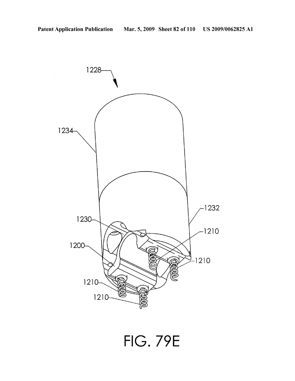 ADJUSTABLE IMPLANT AND METHOD OF USE - diagram, schematic, and image 83