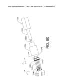 ADJUSTABLE IMPLANT AND METHOD OF USE diagram and image