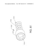 ADJUSTABLE IMPLANT AND METHOD OF USE diagram and image