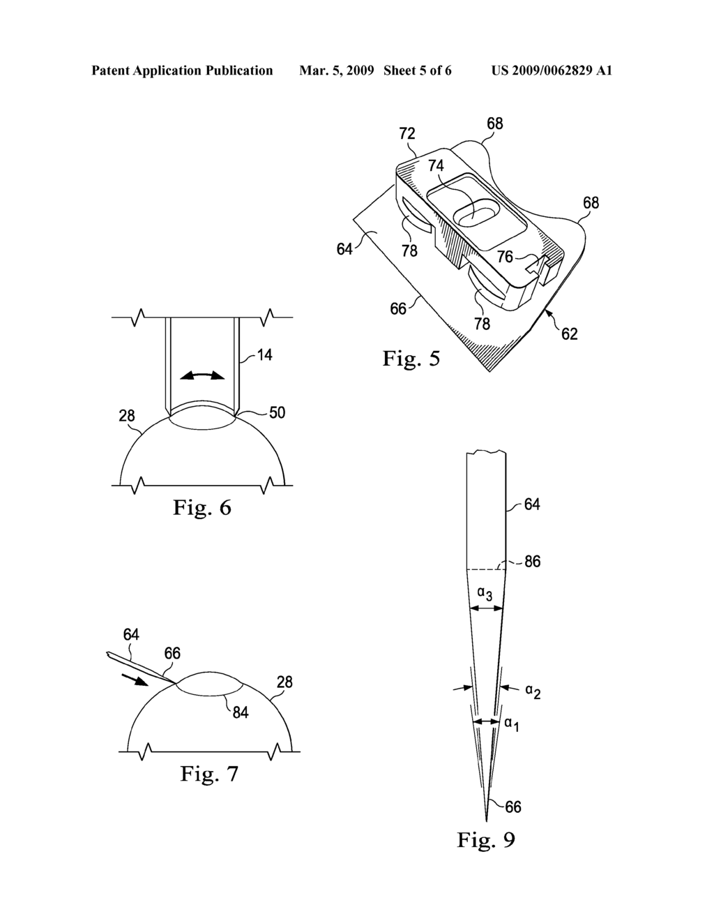 Microsurgical Cutting Instrument for Refractive Ophthalmological Treatments - diagram, schematic, and image 06