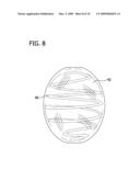 ANEURYSM OCCLUSION DEVICE CONTAINING BIOACTIVE AND BIOCOMPATIBLE COPOLYMER SHELL AND BIOCOMPATIBLE METALLIC FRAME MEMBER diagram and image