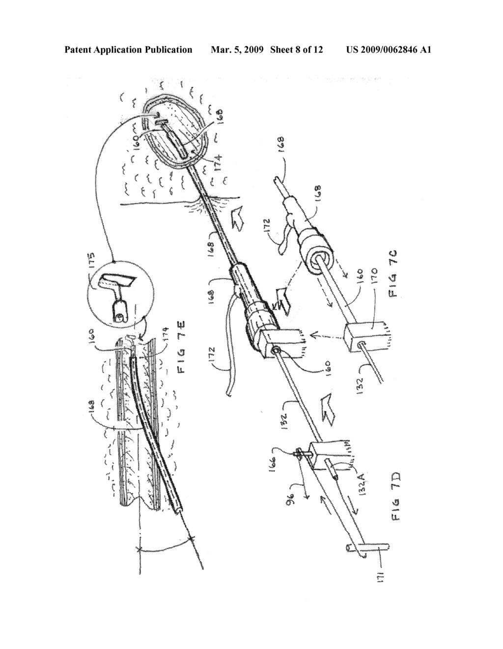 CLOSURE MEDICAL DEVICE - diagram, schematic, and image 09