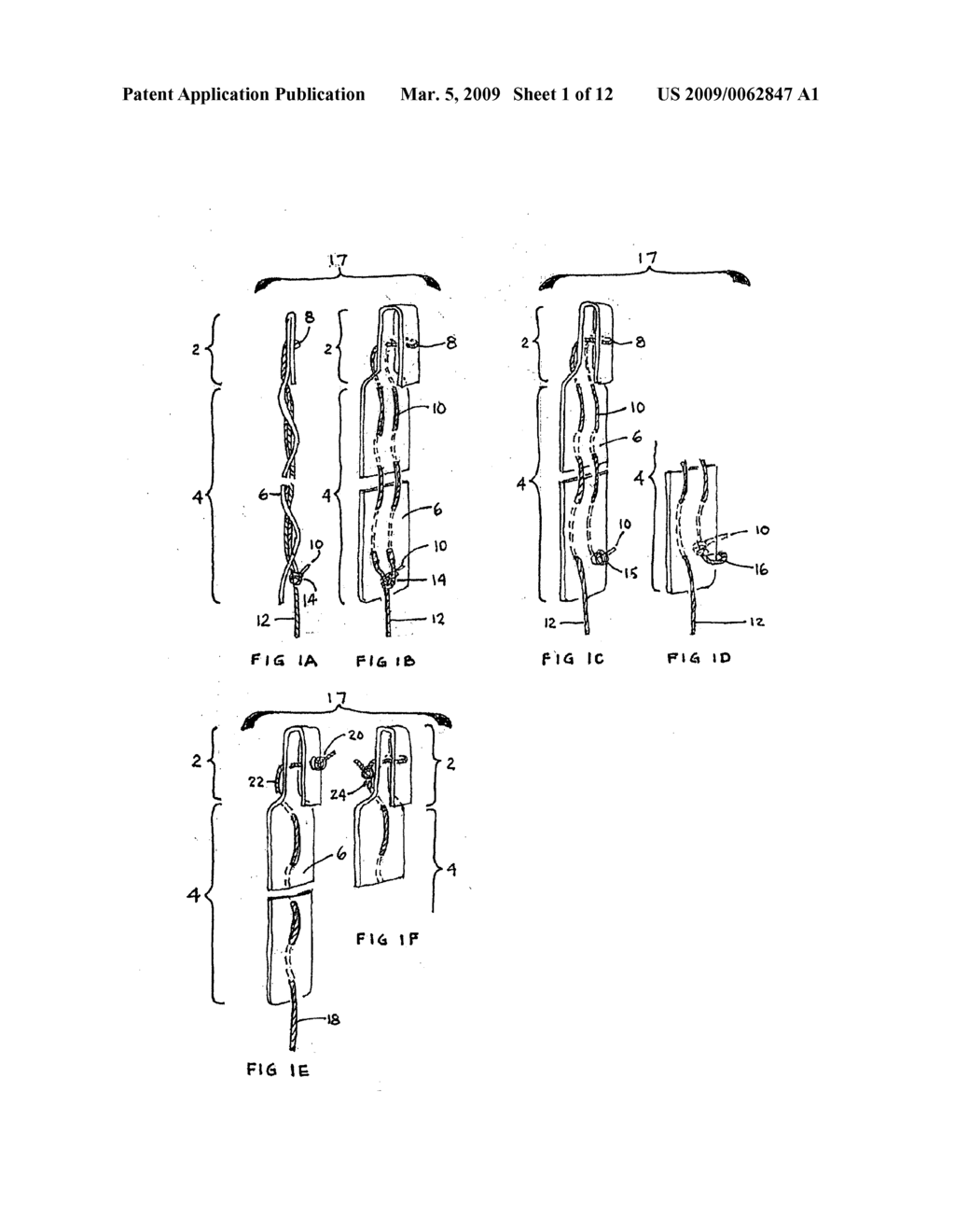 CLOSURE MEDICAL DEVICE - diagram, schematic, and image 02